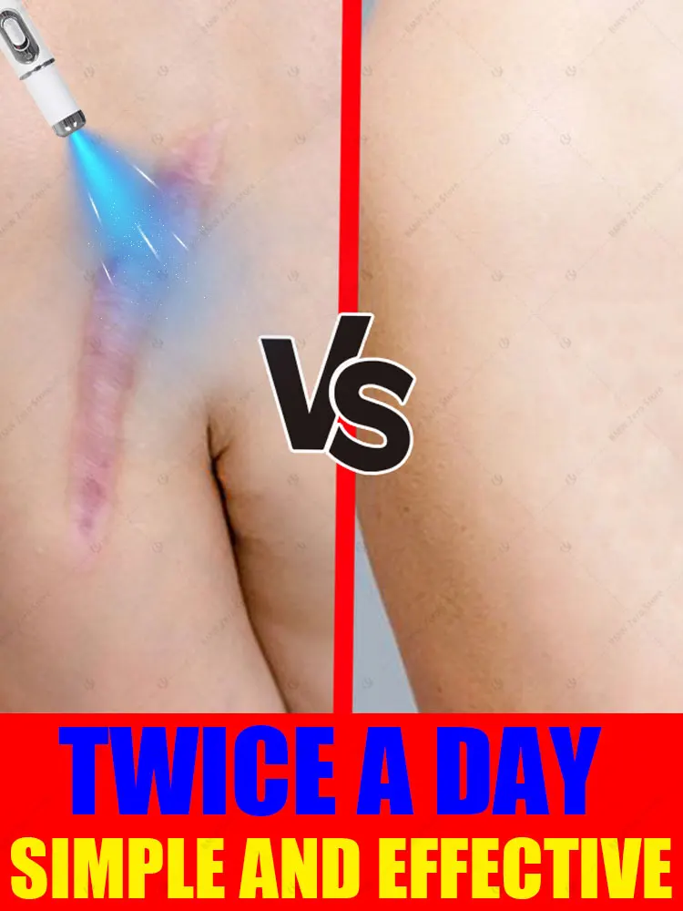 

The latest scar removal technology, remove scars in 7 days, best-selling product in Asia