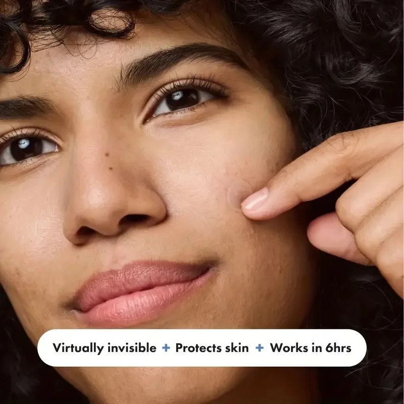 180 pcs Plester Jerawat Hidrokoloid Warna Kulit, Stiker Noda Tak Terlihat untuk Wajah, Tahan Air & Lembut untuk Menutupi Noda untuk Penggunaan Sehari-hari