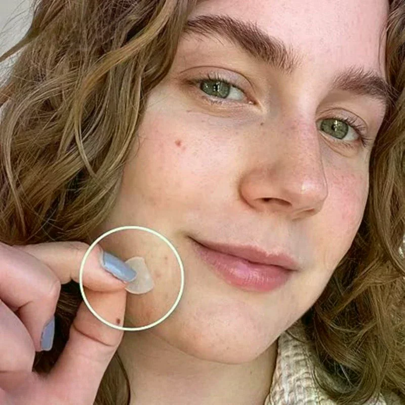 720 قطعة من رقع حب الشباب للعناية بالبشرة، ملصقات دائرية شفافة ولون البشرة، أدوات مكياج لتغطية بقع الوجه للبشرة الواضحة #3