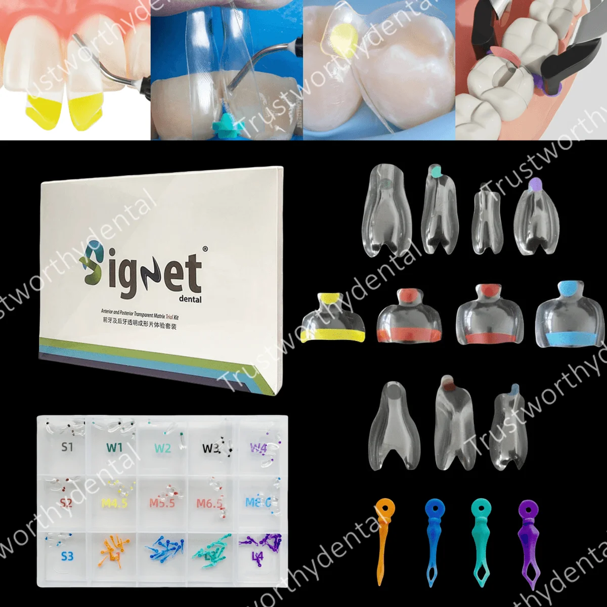 150pcs Dental Clear Matrix Anterior/Posterior Teeth Transparent Matrix Diastema BT Black Triangle Wedges Matrice Fits BioClear