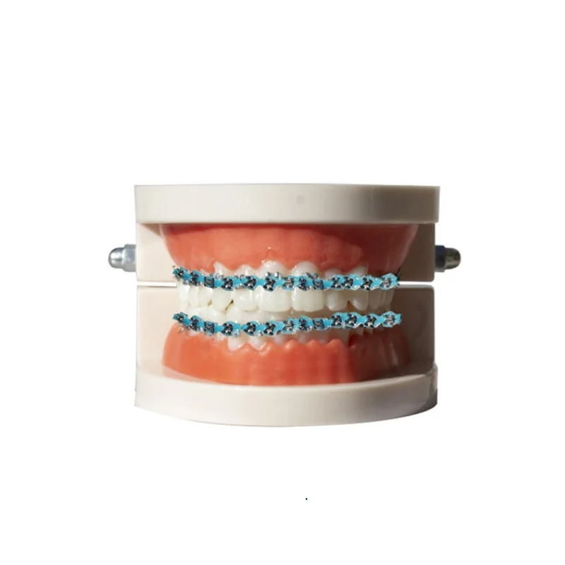 Dental Bracket Orthodontic Brace Colorful Hook Temporary Tooth Decoration  Metal Wires Metal Bracket Orthodontic Ligature Ties