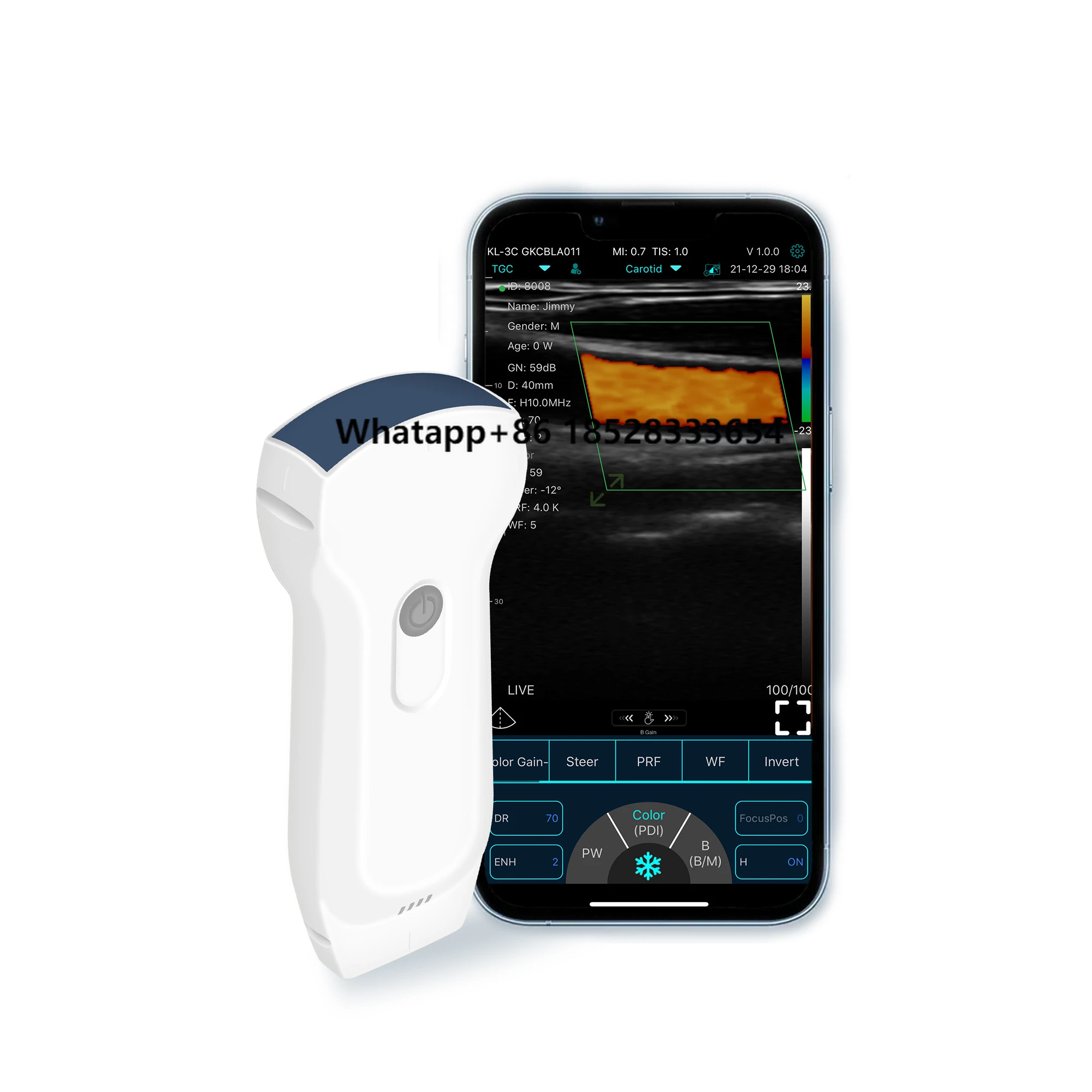 Multifunctional Portable Convex Array Linear Cardiac 3-in-1 Handheld Ultrasound Probe Wireless Ultrasound Probe