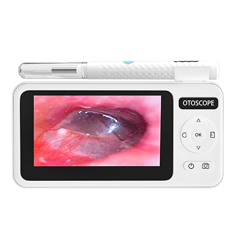 T29 Visual Wifi Ear Wax Removal Tool 1080P Otoscope With 4.2mm Lens 4.3' Screen Ear Wax Cleaner Tool Ear Inspection Camera Set