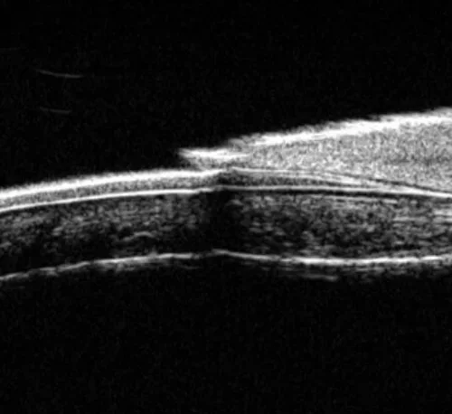 Ophthalmic Ultrasound A Scan SW-1000 Optical Biometer Ophthalmic Pachymeter