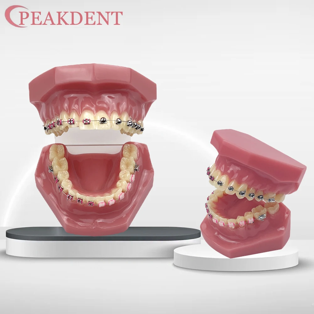 

Normal Dental Orthodontic Teeth Model With Brace Half Metal Half Ceramic Standard Teaching Model Dental Teeth Model For Studying