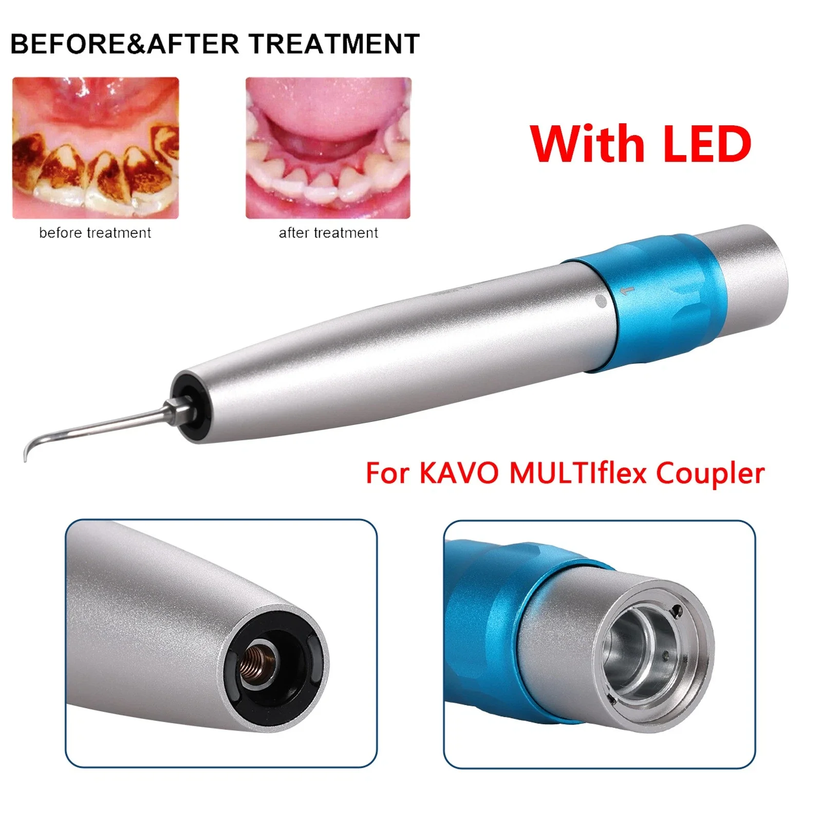 

Dental Air Scaler Fiber Optic Ultrasonic LED SONICflex Sonic L Handpiece 3Tips For Kavo Quick Coupler