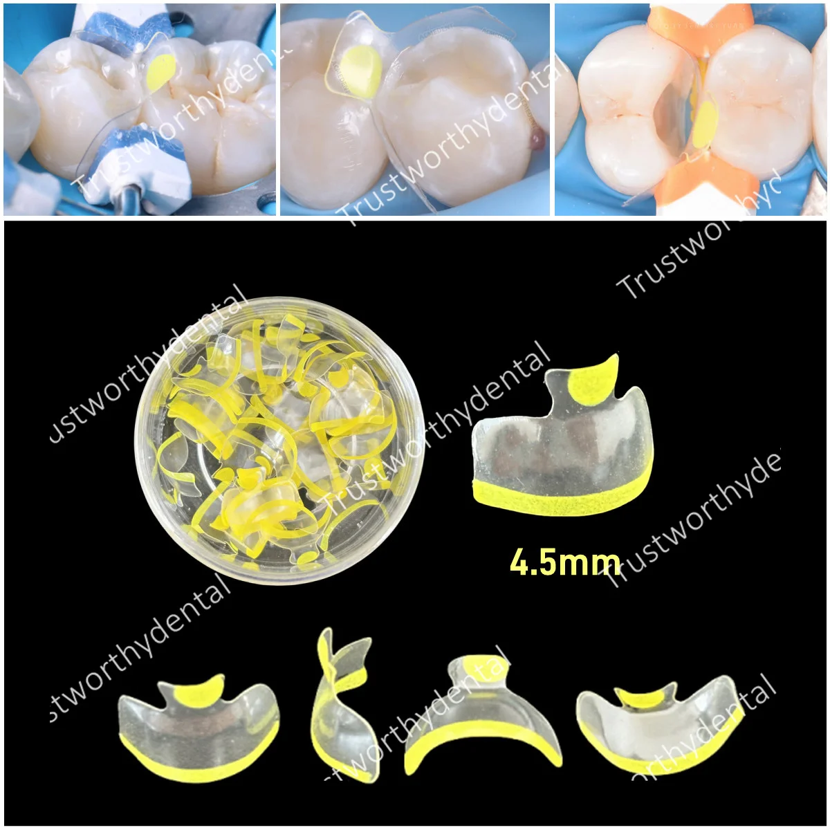 

Dental Clear Matrix Bands Transparent Posterior Molar Teeth 4.5mm Fits Bioclear BT Tooth Restoration