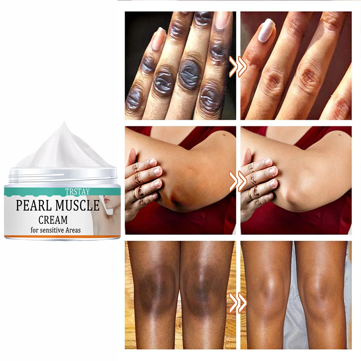 

Отбеливающий крем TRSTAY для ухода за кожей, удаление местного пигментации, улучшение разницы в цвете кожи для частных зон и суставов