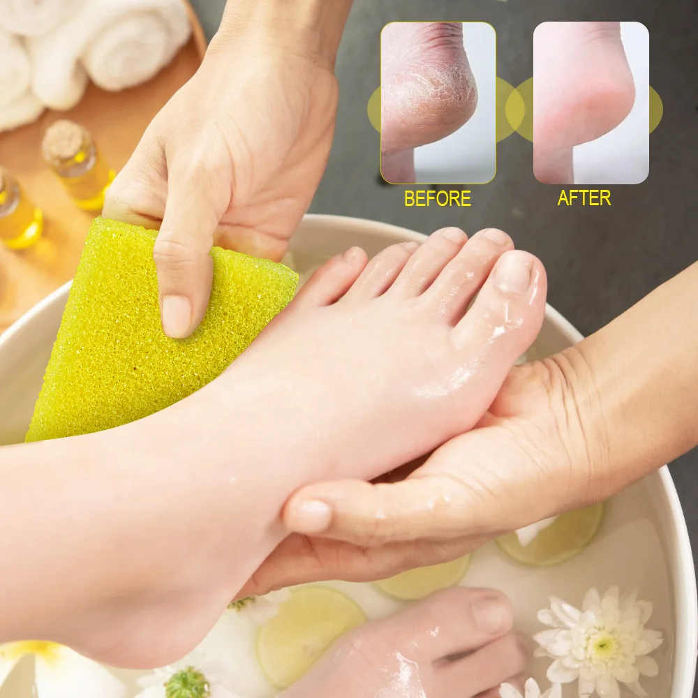 1600Pcs/Case Mini Pumice Pad Medium Grit Dead Skin Callus Removal Tool for Foot