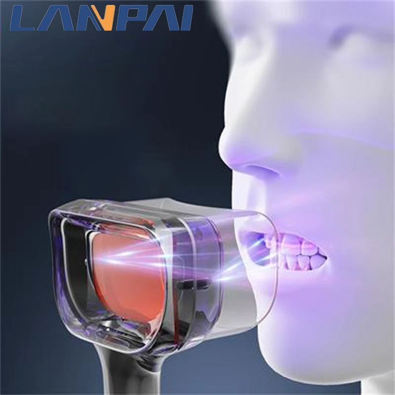 Dental Plaque Indicator Oral Digital Observer Can Be Used By Patients And Doctors To Check Dental Stones