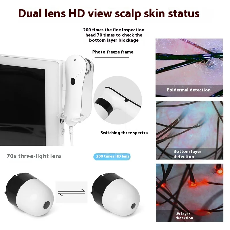 15 Inch Intelligent Scalp Hair Follicle Detector, Skin Analyzer, Care Contrast, Health Monitoring Tool
