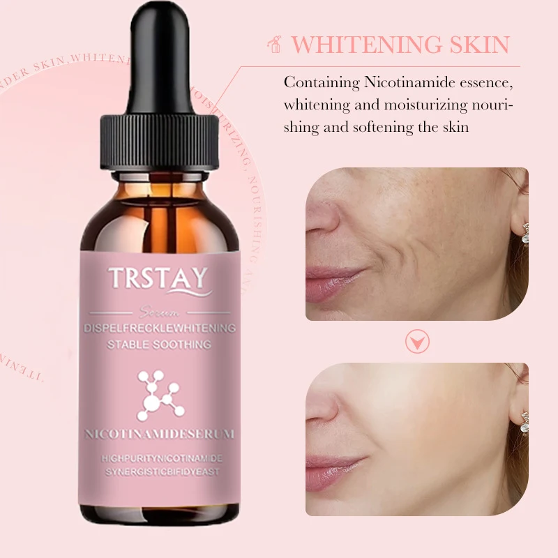 img 5ML/15ML/30ML/50ML/Repair skin barrier improvement Skin darkening, freckle removal, whitening, stable and soothing Nicotinam