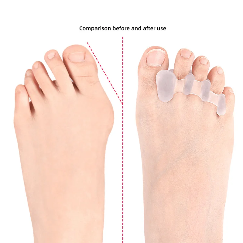 1/5Pairs Gel Hammer Toe Straighten Silicone Separators Corrector Splitter Protector Thumb Valgus Bunion Adjuster Foot Pain Relie