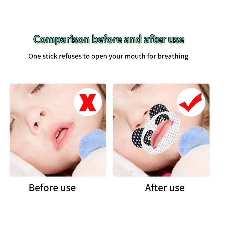 30PCS Kids Cartoon Anti-Snoring Stickers Sleeping Closed-mouth Stickers Breathing Correction Patch Shut Up Patch Orthosis Tape