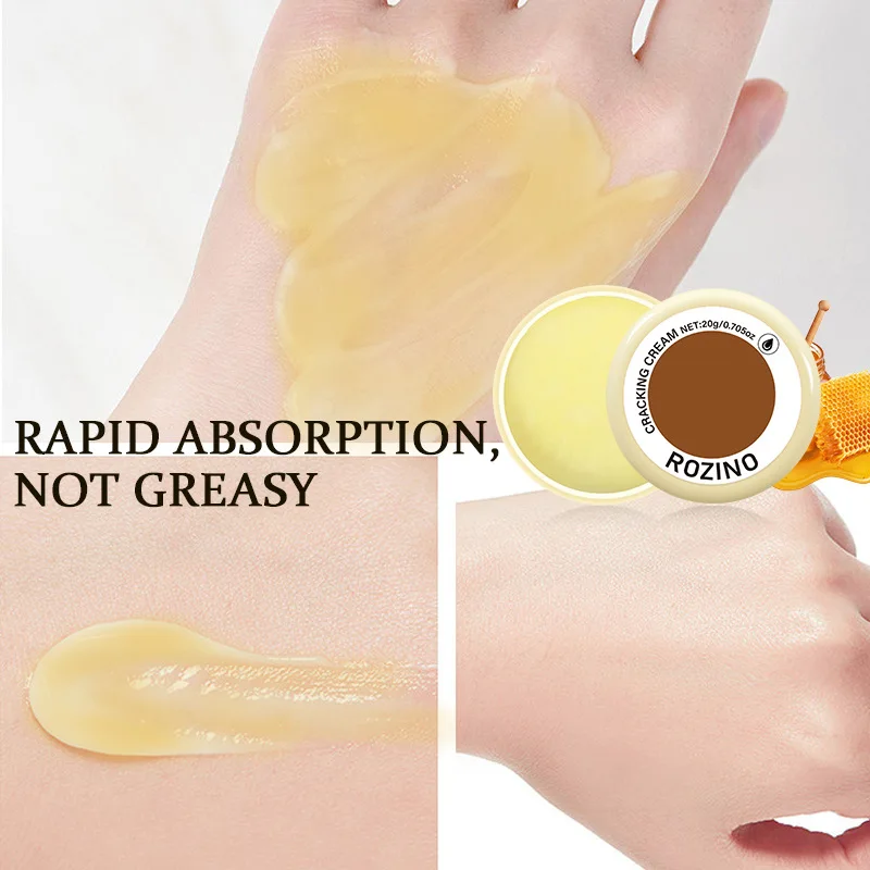 كريم ترطيب البشرة المنشط متعدد الجوهر كريم ترطيب اليدين والقدم كريم العناية بالبشرة كريم ترطيب والعناية #3