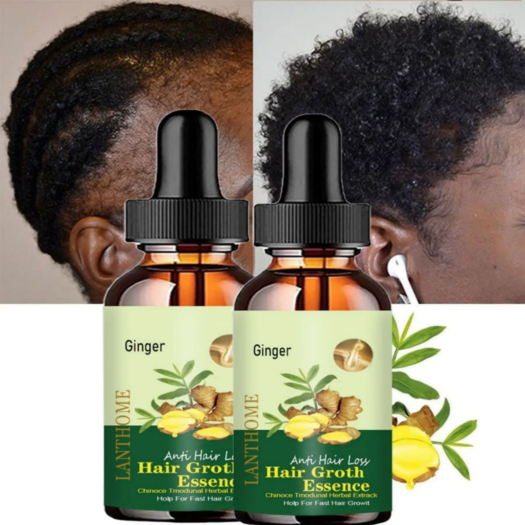 Hair Growth Essence has good permeability, penetrates deep into the hair core, fully absorbs nutrients, and deeply moisturizes