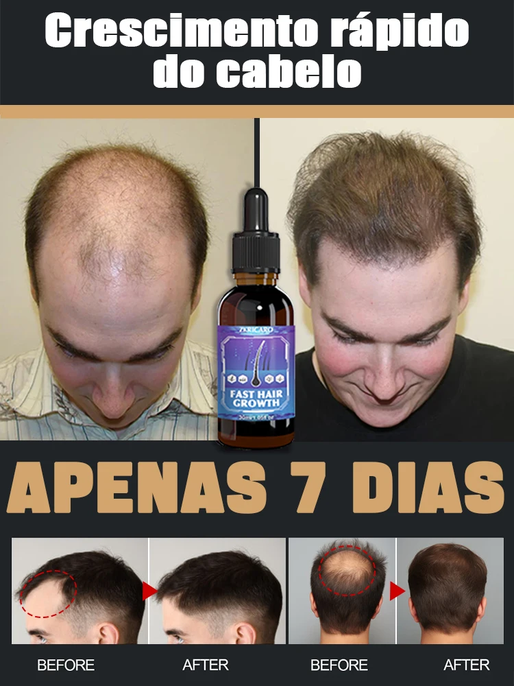 99% of buyers buy again, have more and more hair, say goodbye to baldness, thick hair,Hot selling product