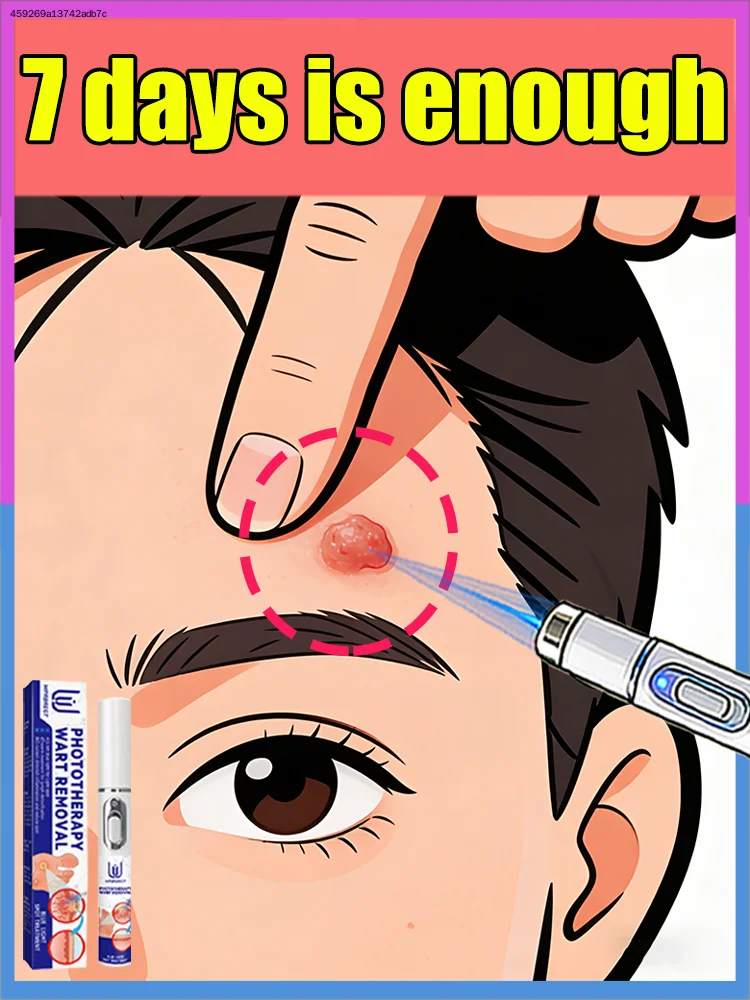 

Treat warts and live your life without any interruption⸴ ⁿᵒ ˡᵒⁿᵍᵉʳ ʰᵃᵛᵉ ᵗᵒ ʷᵒʳʳʸ ᵃᵇᵒᵘᵗ ʷᵃʳᵗˢ