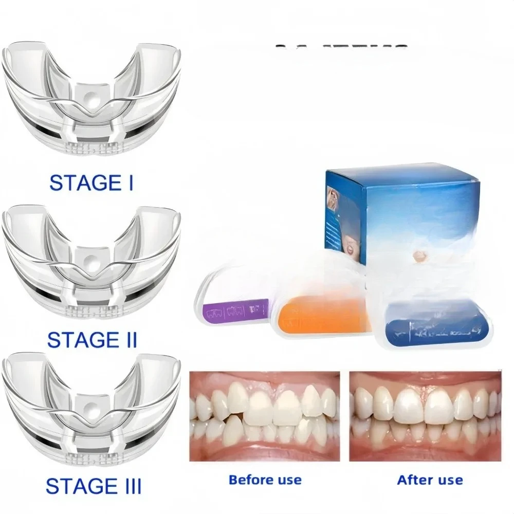 

Брекеты Зубные брекеты Тренажер для выравнивания зубов с улыбкой Мгновенный силиконовый фиксатор зубов Капа Брекеты Зубной лоток
