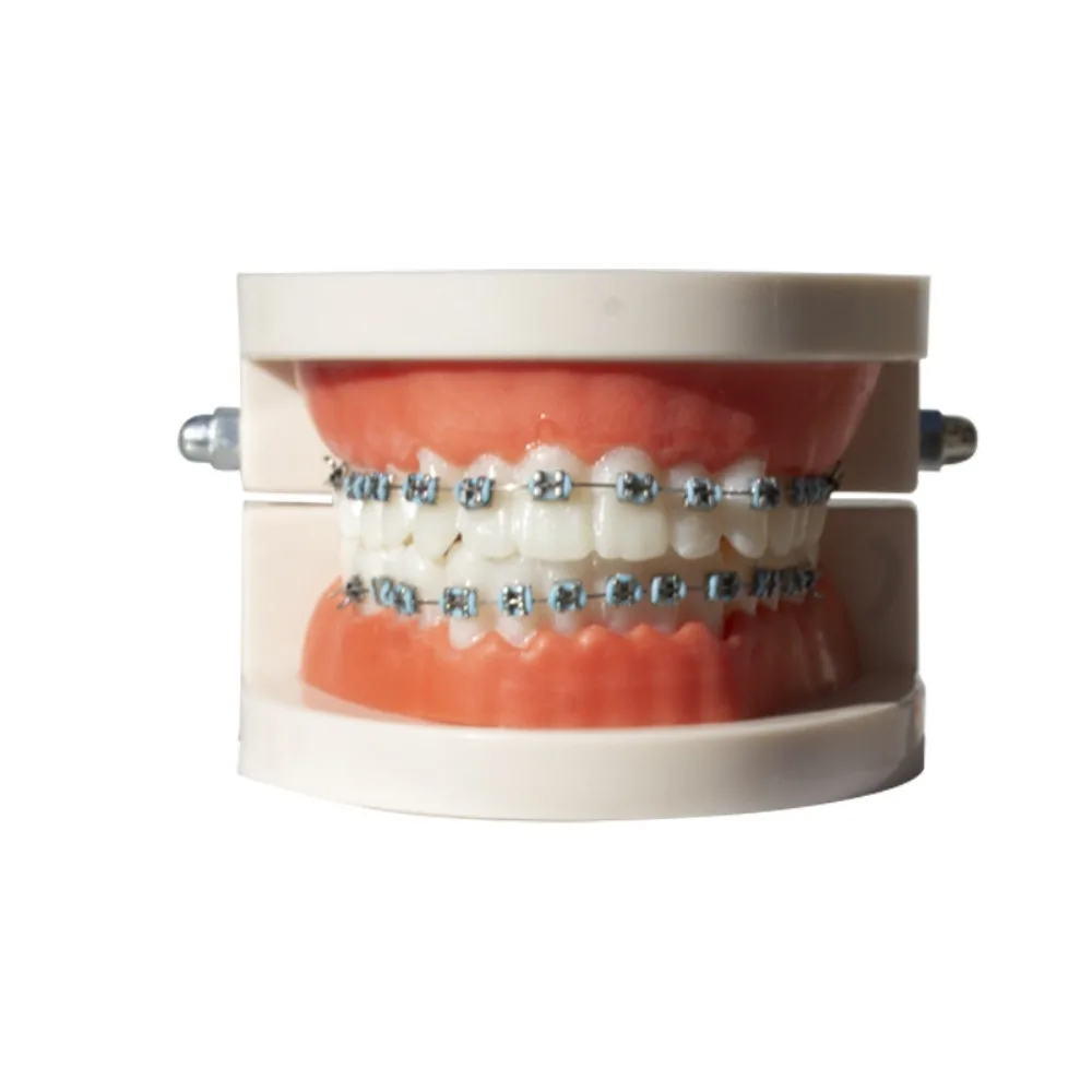 

1 Pair Colorful Temporary Tooth Decoration Dental Decorations Fake Brackets Orthodontic Ligature Ties Braces with Metal Wires