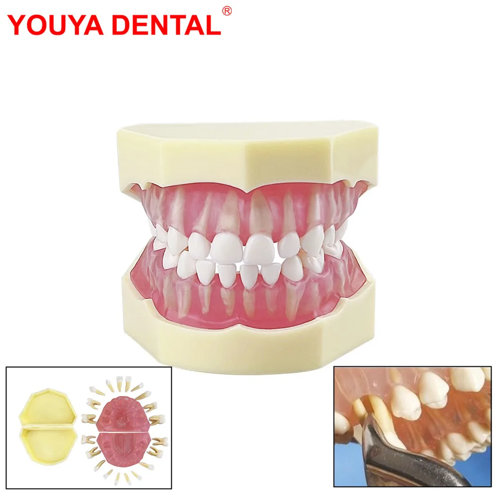 Dental Standard Model With Removable Teeth Kids Teeth Model For Training Practice Tooth Extraction Models Children TYPODONT  New