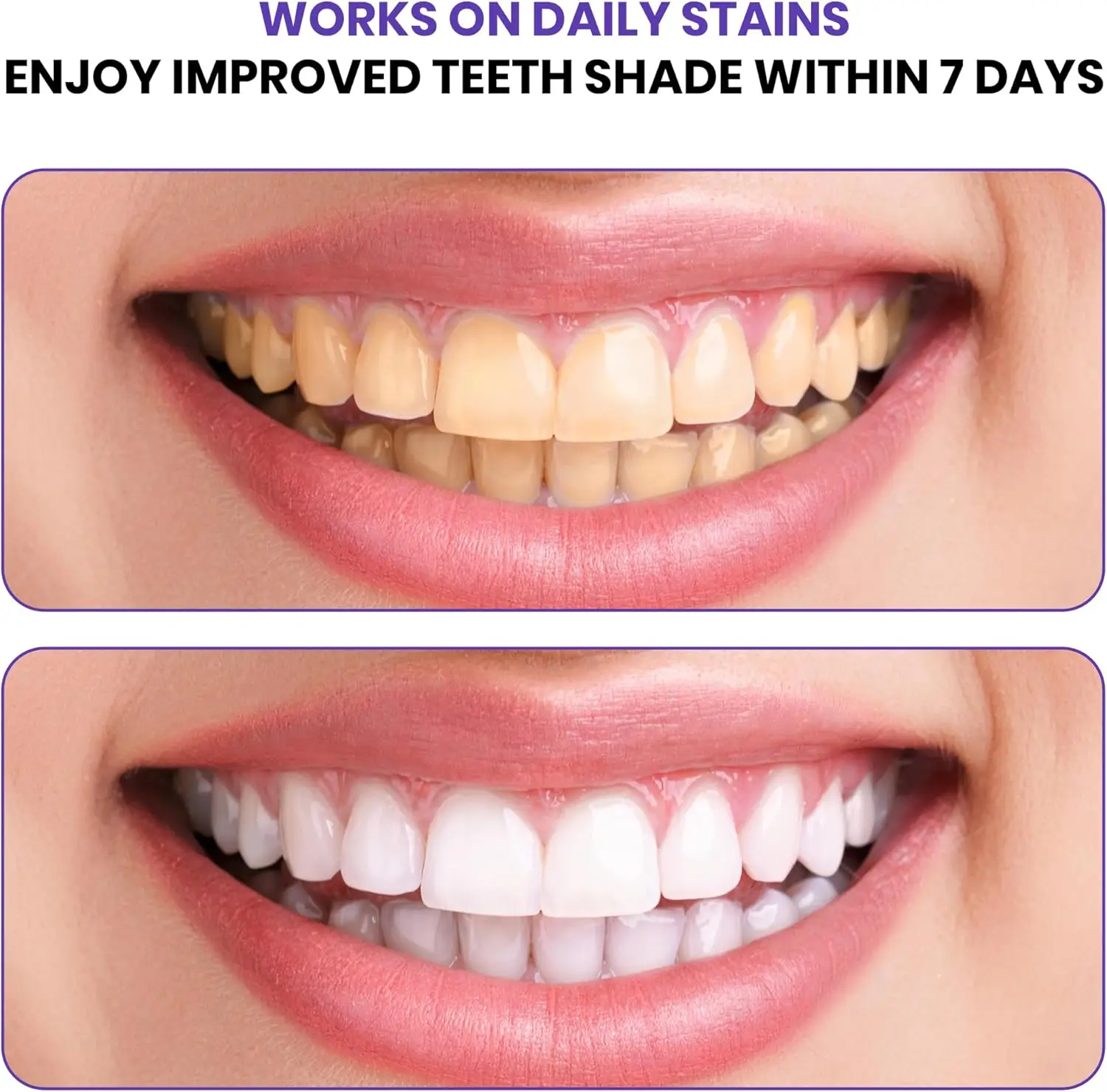 Advanced Purple Teeth Whitening Strips Color Correcting System Enamel-Safe Tooth Whitener for Sensitive Teeth At-Home Smile Care