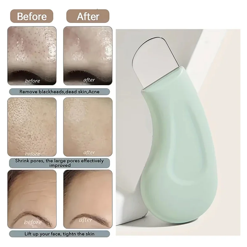 Thumbnail 3 - #27 Latest Skin Care Extractors Offers