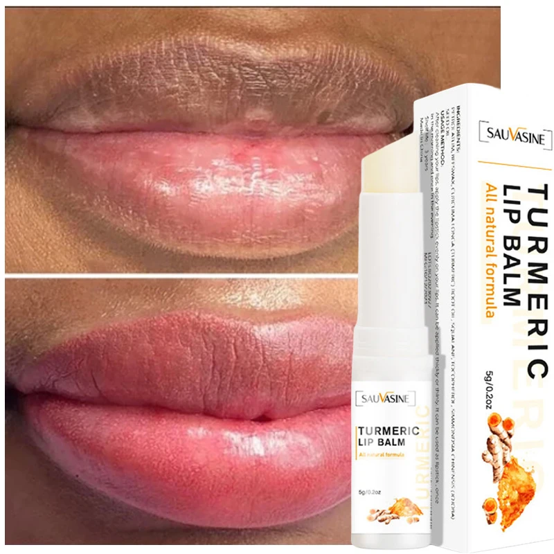 

Fast Lightening Pink Mouth Lips Serum Bleaching Permanent Remove Dark Smoke Lips Lip Balm Moisturize Gloss Lipstick Lip Serum