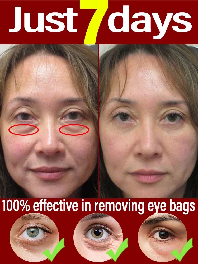 

Массажер Элетомическое отрядное устройство de olhos