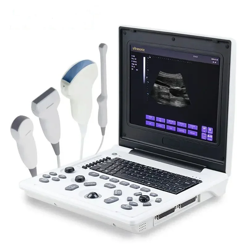 Digital Echocardiography Instruments Sonography Ultrasonography Laptop Black And White Portable Medical Ultrasound Scanner USG