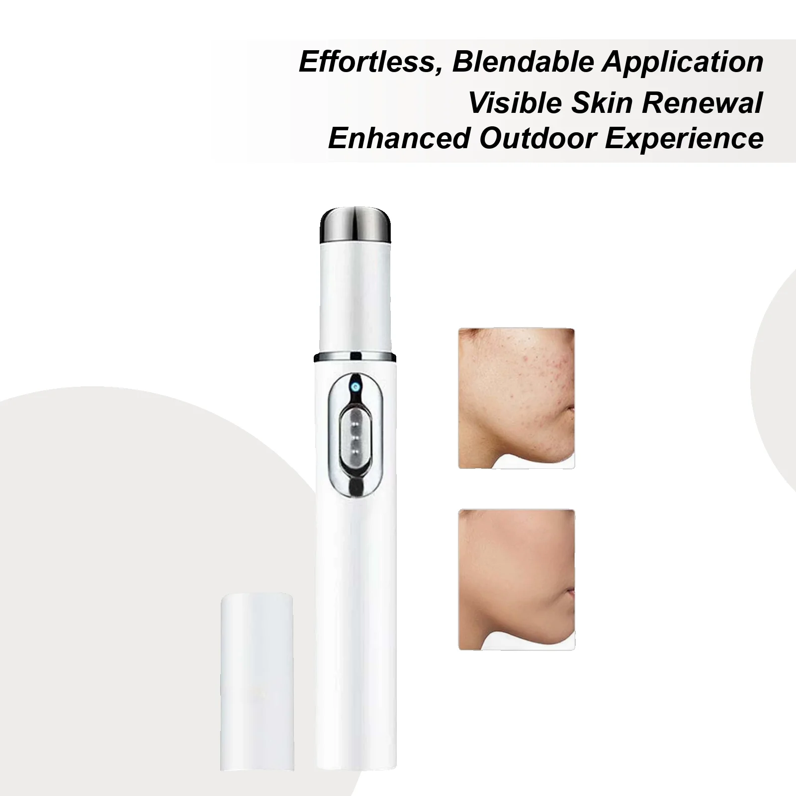 Mole Remover Pen Portable Skin Pen Women Accessory for Face Elbow Private Sun Buttocks Back Inner Armpit Thighs Legs Chest