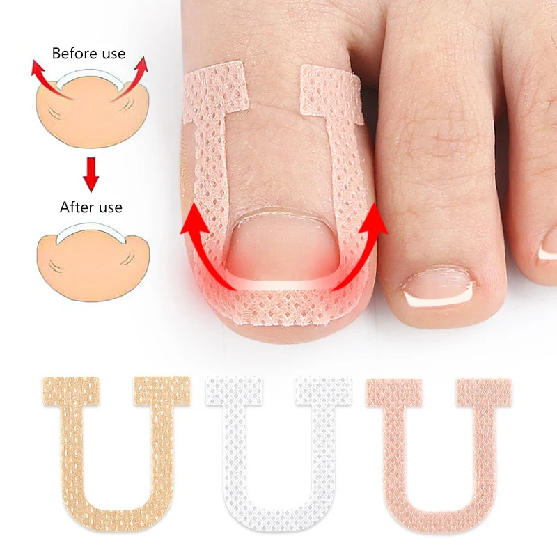 Patch Adhésif pour Ongles Incarnés, Autocollant artificiel astique de Traitement des Ongles, Outils de Soins des Pieds, 4 Pièces/Feuille