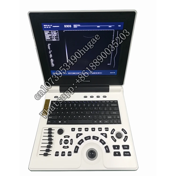 XF30B VET Full Digital Laptop Scanner Veterinary Portable Ultrasound Physiotherapy