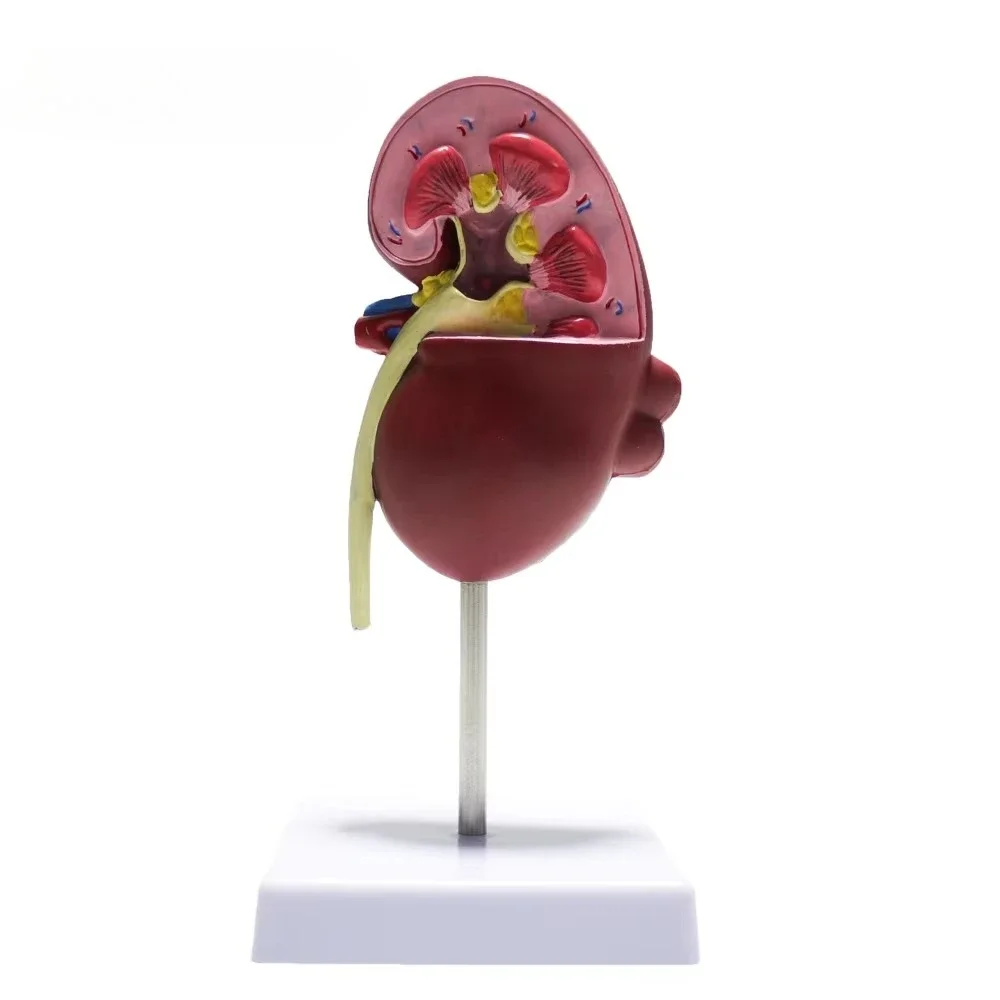 Medical teaching aids for human normal and pathological kidney models