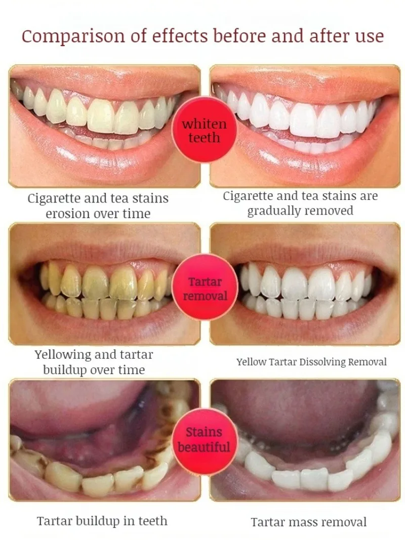 Probiotic Toothpaste Fresh Breath Bright Teeth White Reduce Stained Teeth Yellow Effective Anti-Cavity Clean Plaque Toothpaste