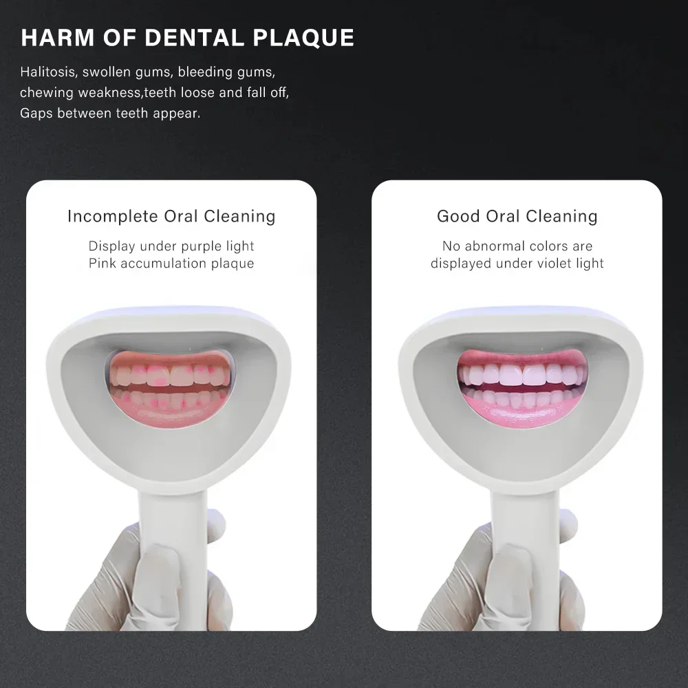 dentals Plaques Detectors dentals Stone Plaques Detectors Oral Health Display Instruments