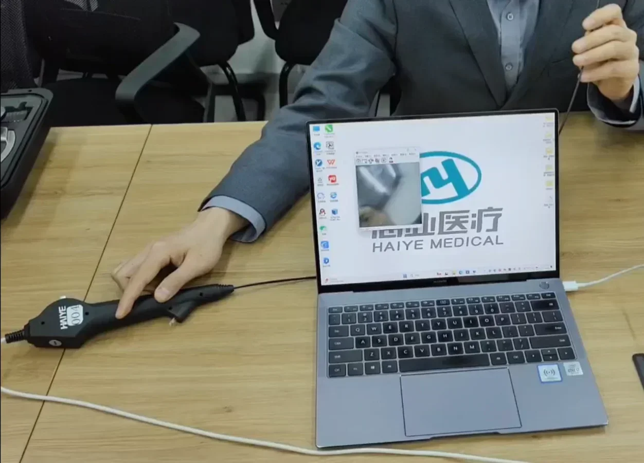 

NEW advanced economical single-use flexible video ureteroscope ureteroscopy device for urological treatment