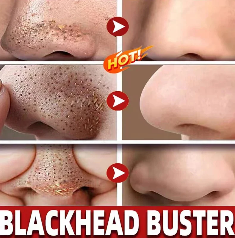 Blackhead odstraňovač nos maska pore proužky loupání akné léčba hlubokým asanace obličej maska pórů zmenšuje kůže krása péče produkt