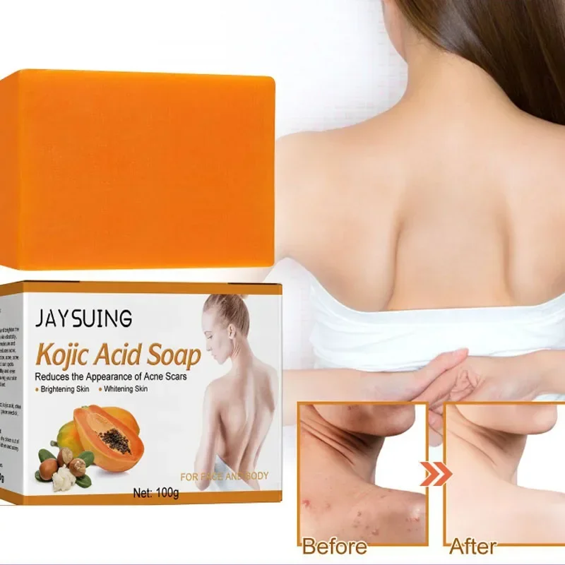 Kojic Acid Soap Skin Lightening Handmade Whitening Soap Bleaching exfoliating dilute acne Deep Cleaning Brighten Skin care