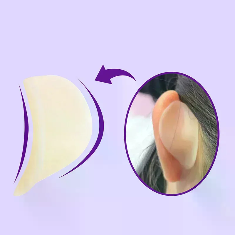 สติกเกอร์ซิลิโคนรูปหูเอลฟ์ 4D รุ่นอัพเกรด แผ่นแปะแก้ไขรูปทรงหูแบบติดเอง ใช้ซ้ำได้ สติกเกอร์หน้าวี ใช้งานง่าย แผ่นแปะเสริมรูปทรงหู
