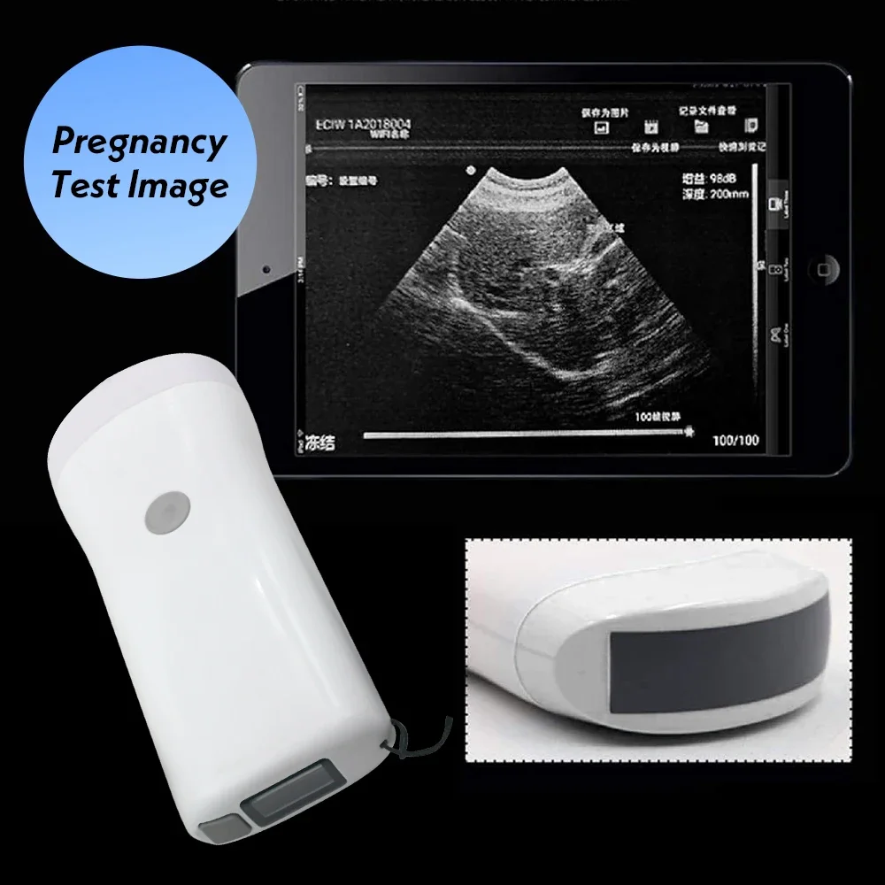 80 Element Veterinary Wireless Ultrasound Scanner Portable Handheld Pregnancy Test Ultrasound Machine for Pig Sheep