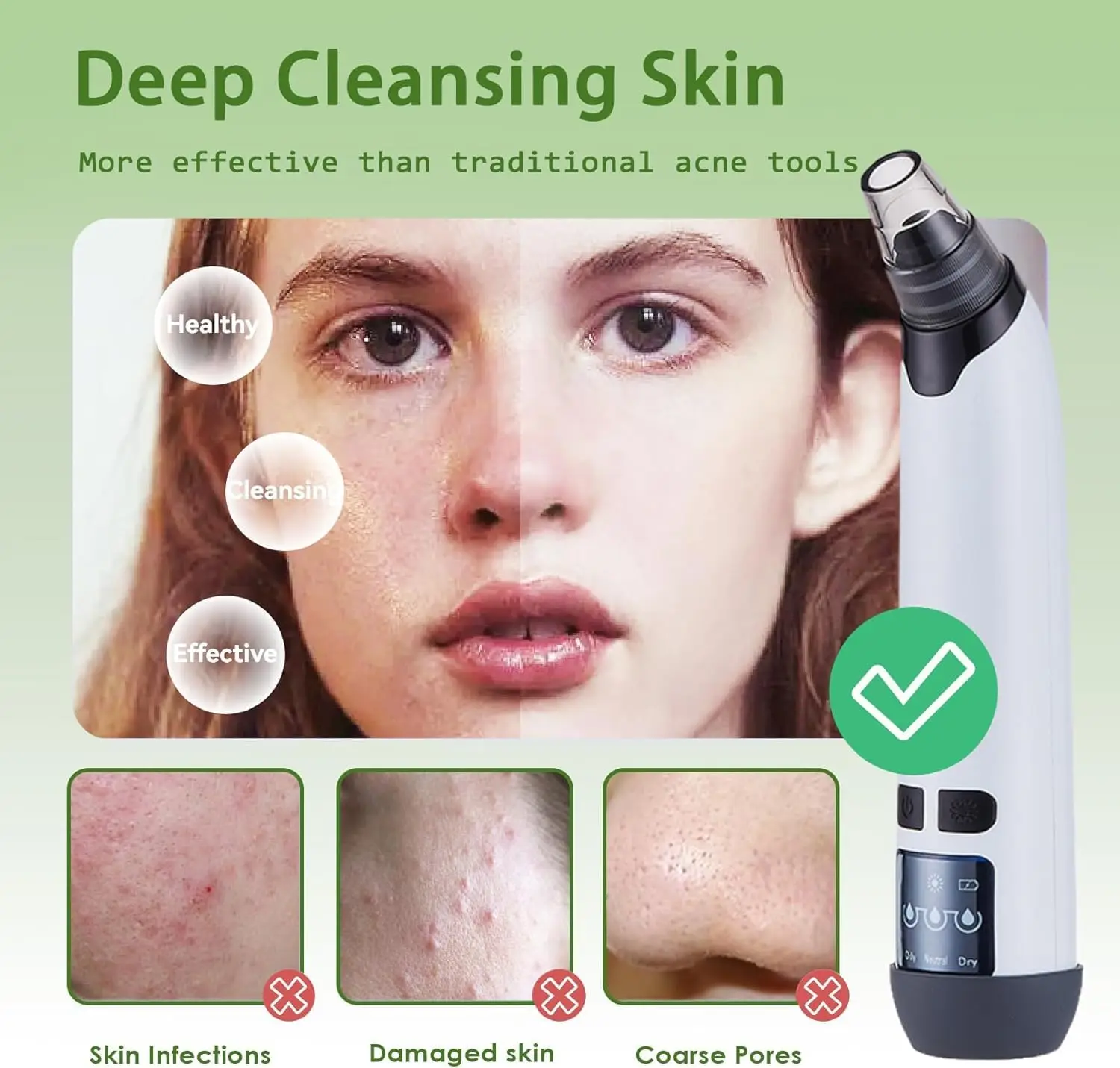 Heet Kompres Facial Comedondrukker Vacuüm Zuig Acne Porie Schoner Tool Elektrische Neus Gezicht Diepe Reiniging Huidverzorging Apparaat
