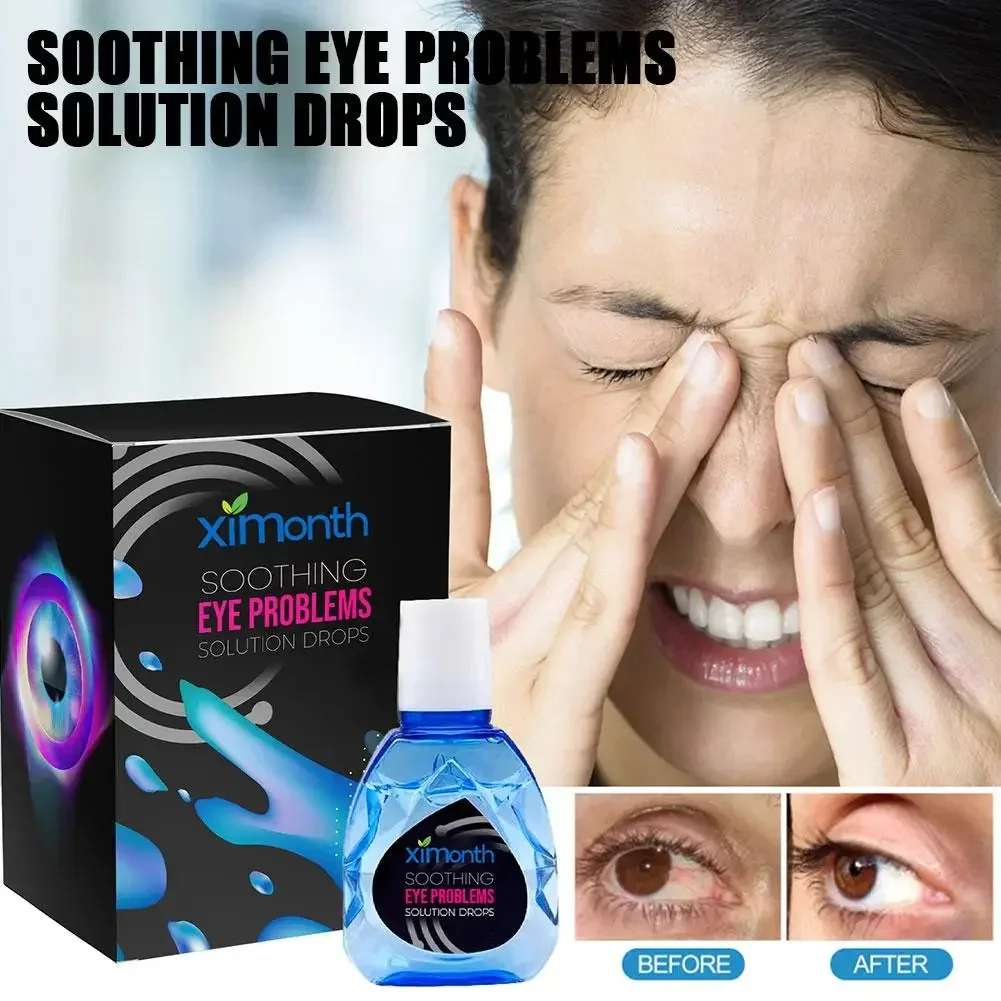 

10ml Treatment Eyeproblems Solutiondrops Eye Soothing Remove Eye Dark Fatigue Circles Eyesight New Improve Drops Eye Reliev K3m5