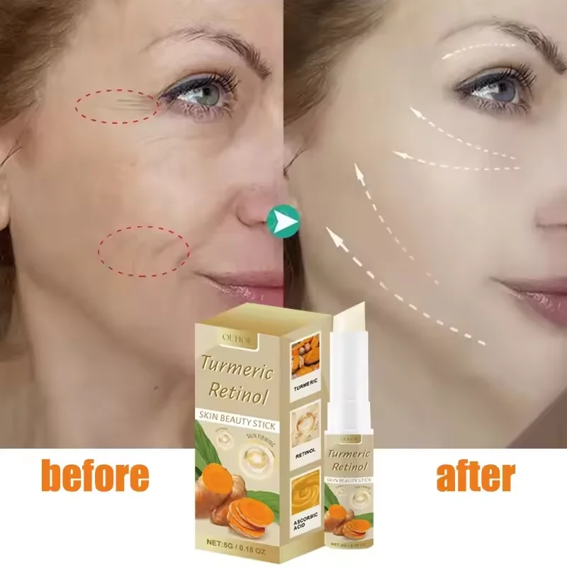 

Retinol Eye Cream Anti-wrinkle Eye Cream Stick Firming Moisturizing Puffiness Black And Circles Deep Lightening Skin Care