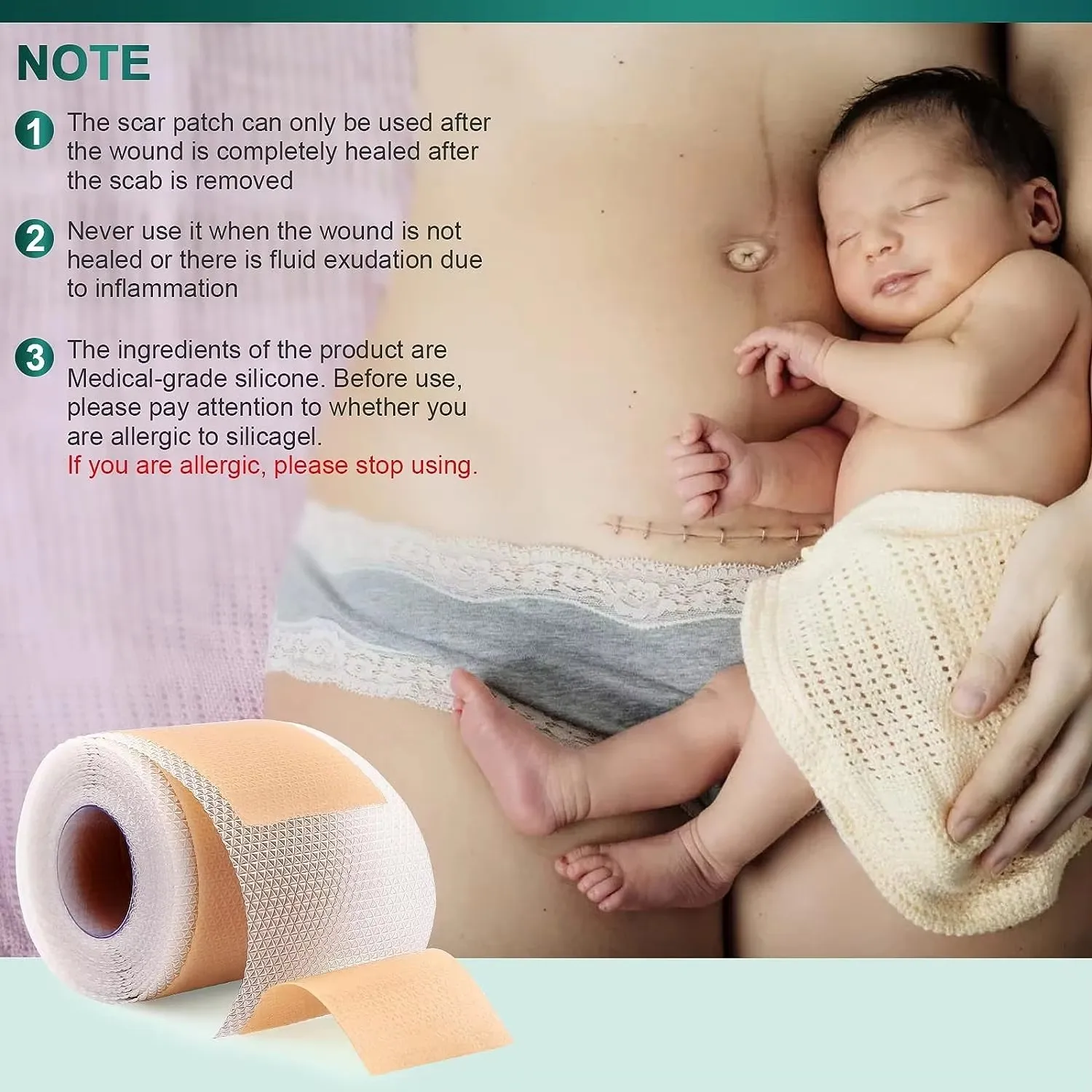 50/100/150 centimetri Gel di Silicone Cicatrice Copriletto Patch Trattamento Rimozione Nastro Acne Trauma Bruciare Cicatrice Copertura Sezione di Riparazione Della Pelle Orecchio bellezza