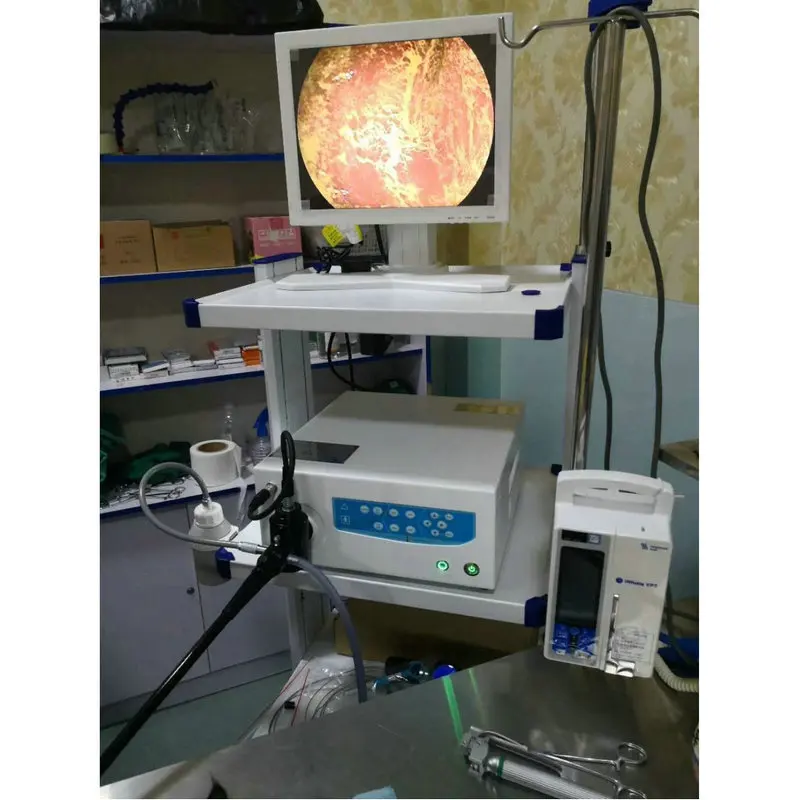 Video Flexible Electronic Endoscopy SystemGastroscope Colonoscope Bronchoscope Co2 Insufflator for Medical Diagnostic Procedures