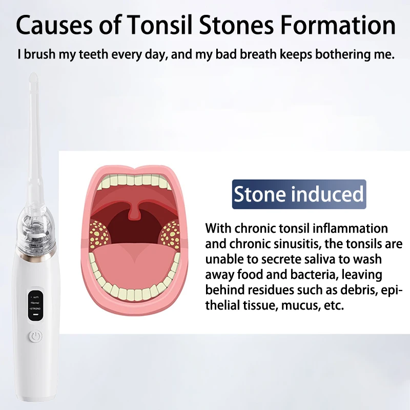 1Set Electric Tonsil Stone Remover Tonsil Stone Removal Kit Vacuum With Irrigation Syringe Instant Suction Tonsil Stone Removal