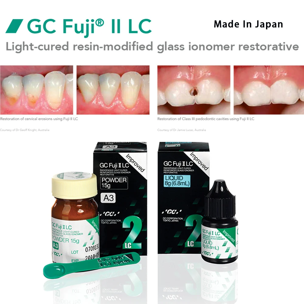 Gc Fuji 2 Lc Luting Dental Light Cure Glassionomer Cement Resin Reinforcement Restoration Filling Material II Gic Dentistry