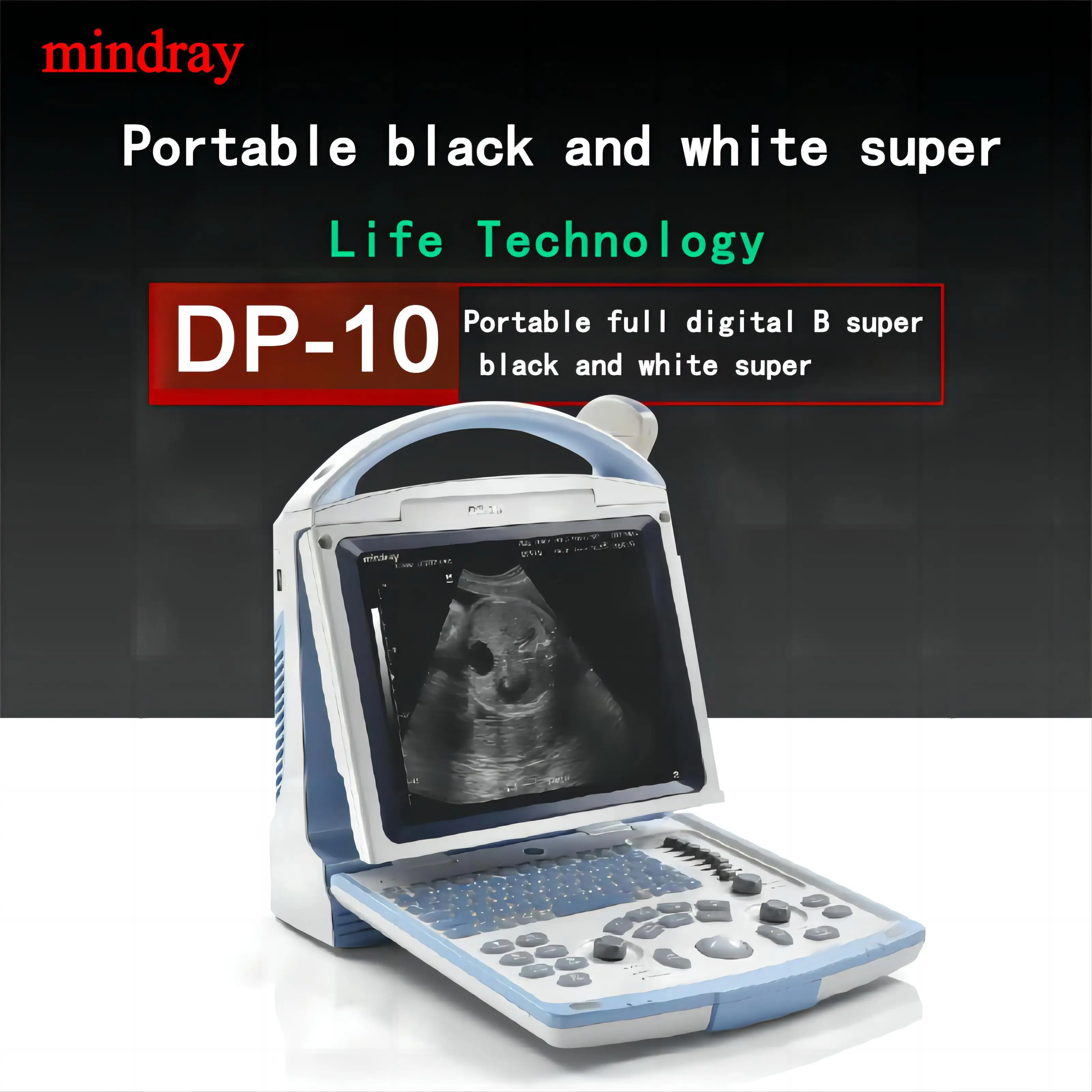 Medical Equipment DP-10 Mindray Ultrasound Machine Portable Black and White Ultrasound Machine DP 10