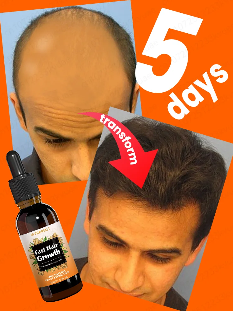 Aɴᴛɪ ʜᴀɪʀ ʟᴏss, ʜᴀɪʀ ғᴀsᴛ ɢʀᴏᴡᴛʜ ɴᴜᴛʀɪᴛɪᴏɴ ᴇssᴇɴᴄᴇ